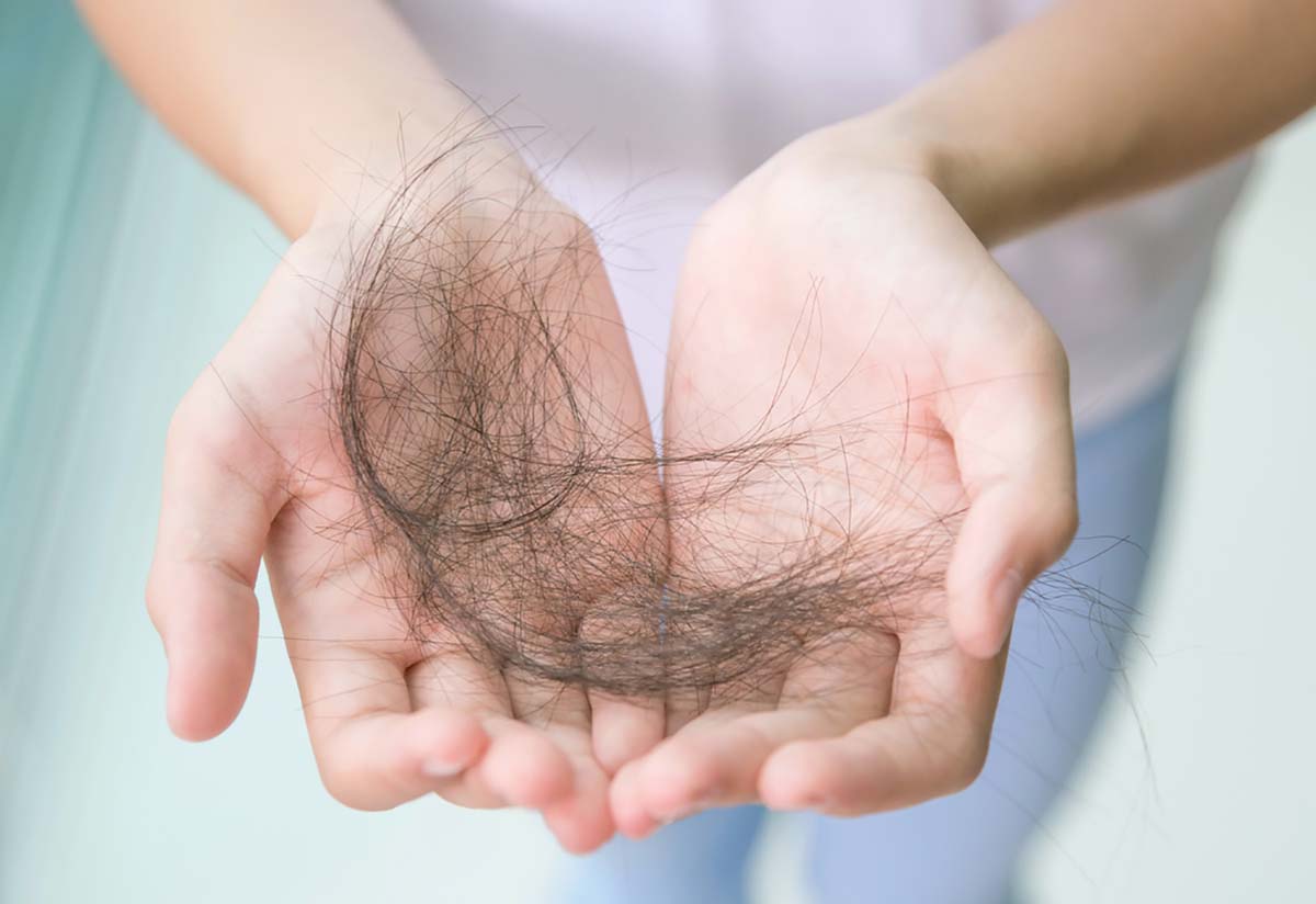 ăn đồ chiên nhiều có thể khiến tóc bị rụng ăn đồ chiên nhiều có thể gây rụng tóc