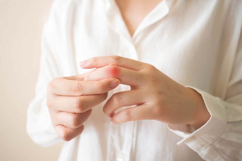 cách giảm đau bệnh gout