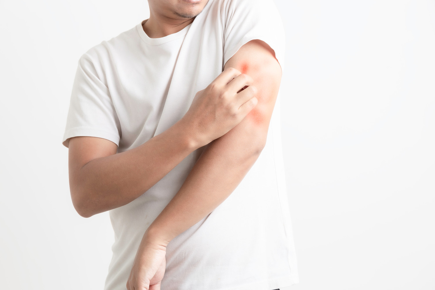 dị ứng cồn có thể gây ra nhiều vấn đề sức khỏe dị ứng cồn có thể gây nhiều vấn đề sức khỏe