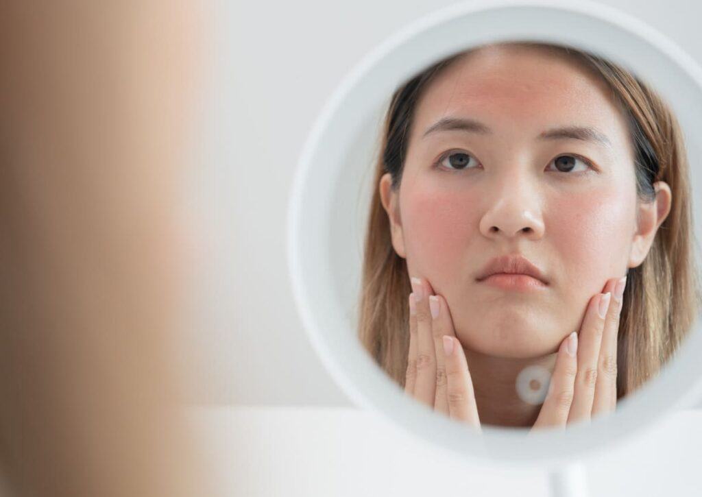 da mặt khô bong tróc