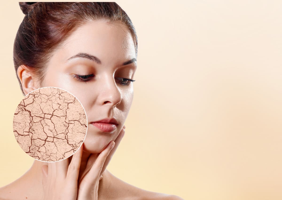 Mách bạn bí quyết xua tan nỗi lo da mặt khô bong tróc vào mùa lạnh 35 Nguyên nhân da mặt khô bong tróc vào mùa lạnh