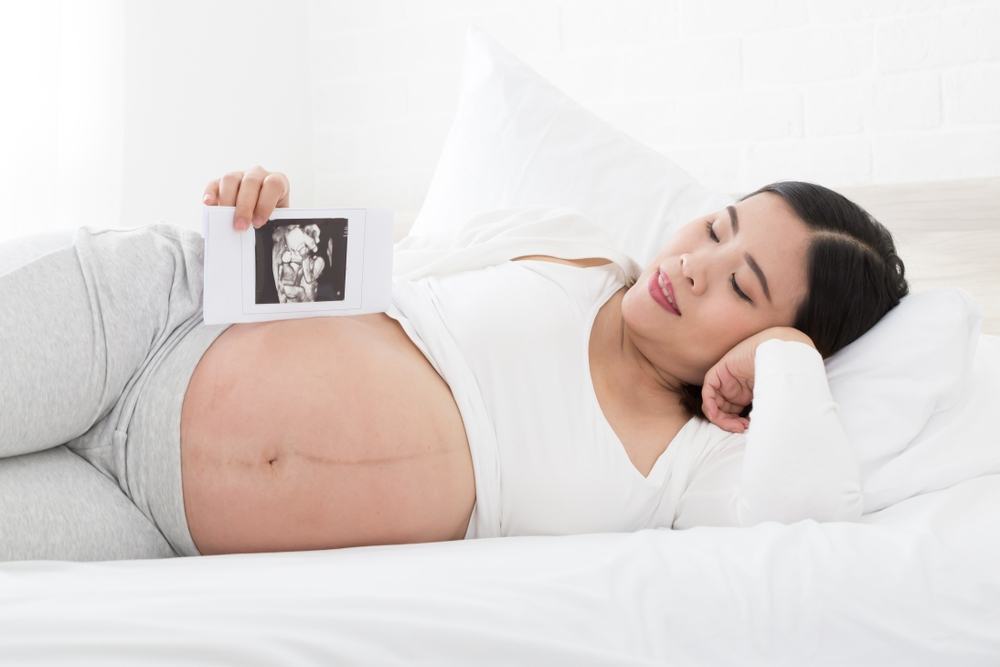 theo dõi thai nhi đạp bằng cách nằm nghiêng bên trái