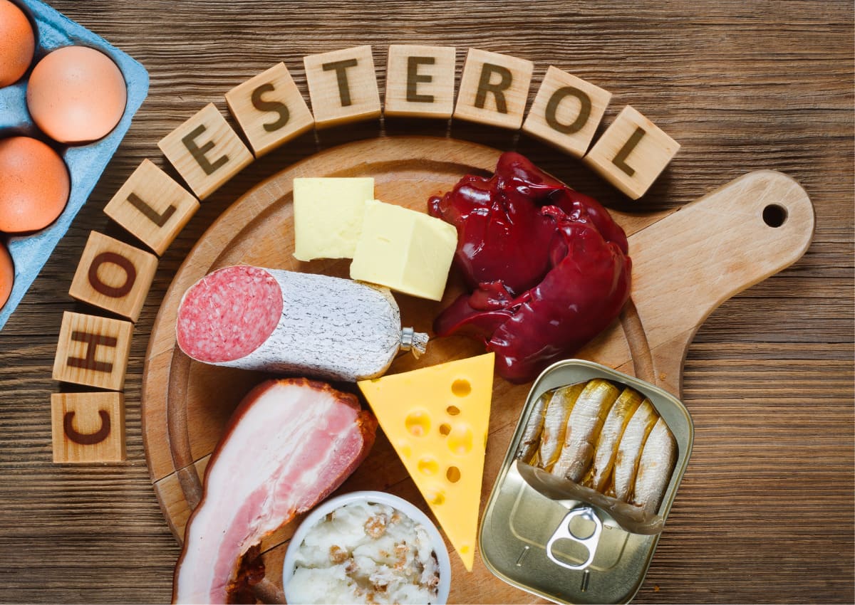 Cholesterol cao nguy hiểm ra sao và bí quyết ổn định cholesterol trong máu 37 Cholesterol cao nên ăn gì và kiêng gì