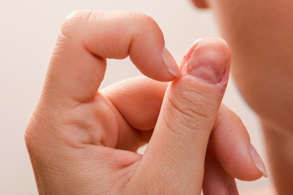 cắn móng tay bị hoại tử móng tay cắn móng tay bị hoại tử