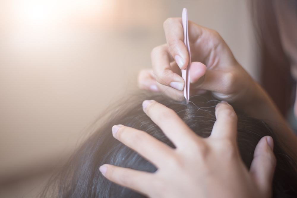 tóc bạc sớm là vì có ít melanin trong keratin tóc bạc sớm là do có ít melanin trong keratin