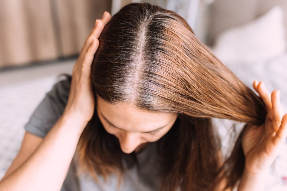 Bí quyết khắc phục tóc bạc sớm để giữ mãi tuổi xuân
