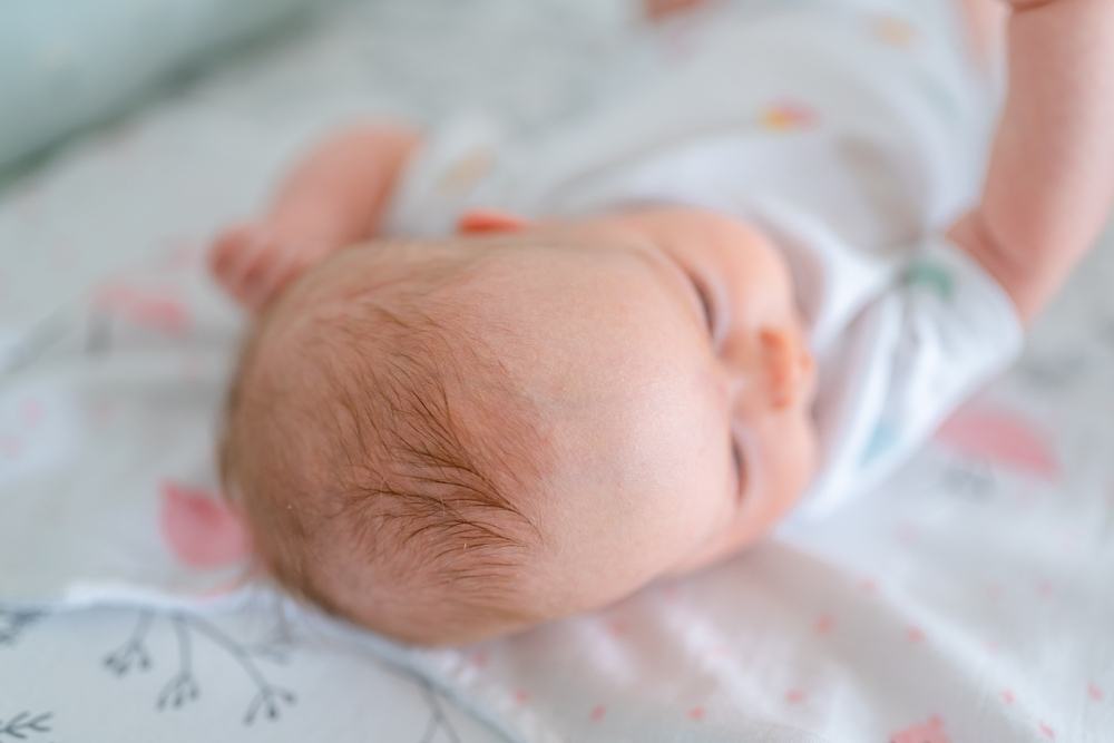 Kích thước của thóp trẻ sơ sinh Kích thước thóp trẻ sơ sinh