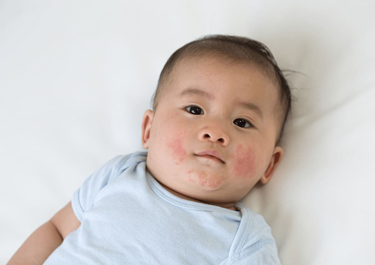 Mách ba mẹ cách chăm sóc da cho bé theo từng mùa chuẩn chuyên gia 36 cách chăm sóc da cho bé theo mùa