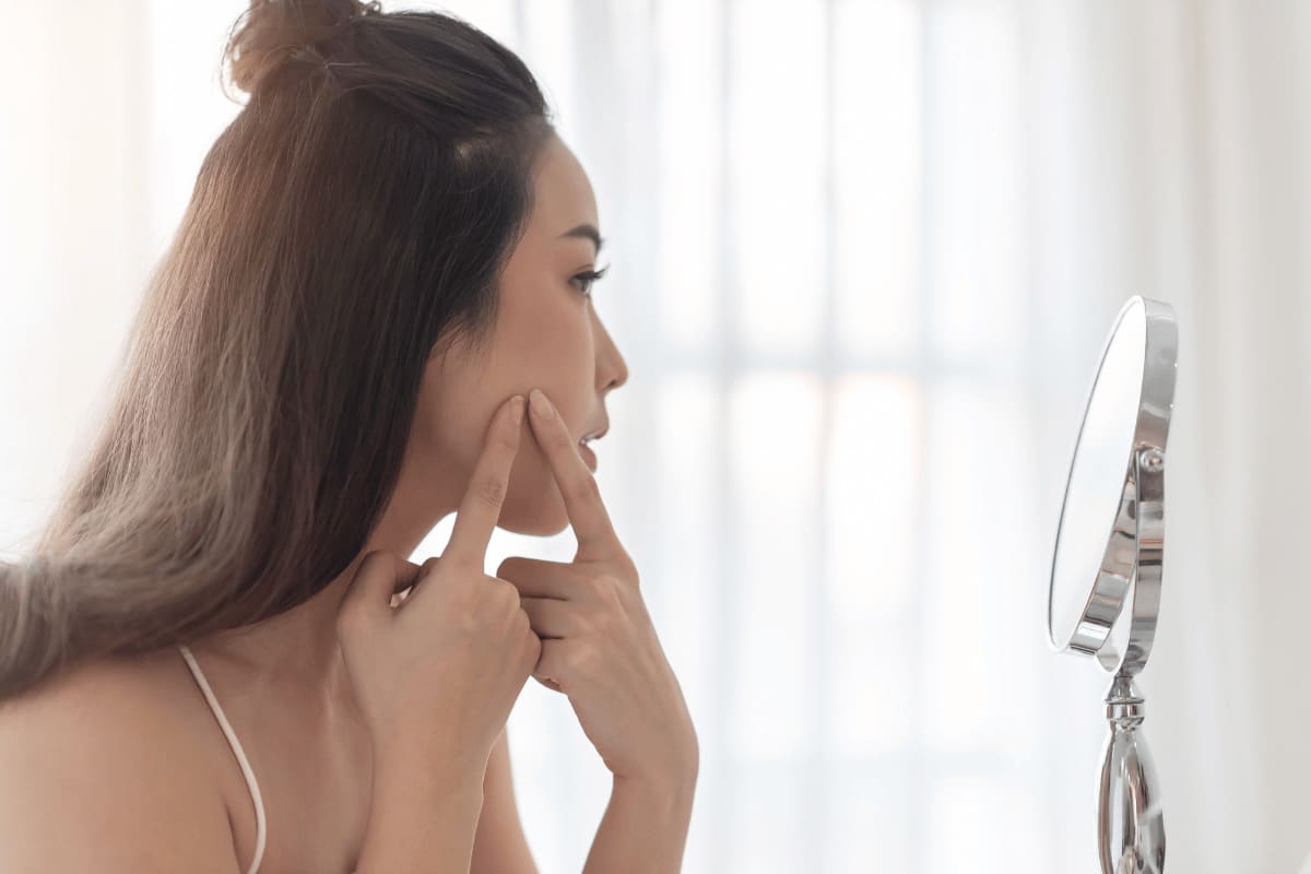 100 ngày làm đẹp trước Tết: Cách loại bỏ mụn đầu trắng công hiệu 36 Làm thế nào để loại bỏ mụn đầu trắng