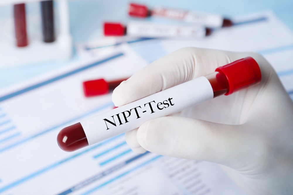 tìm hiểu xét nghiệm NIPT là gì xét nghiệm NIPT là gì