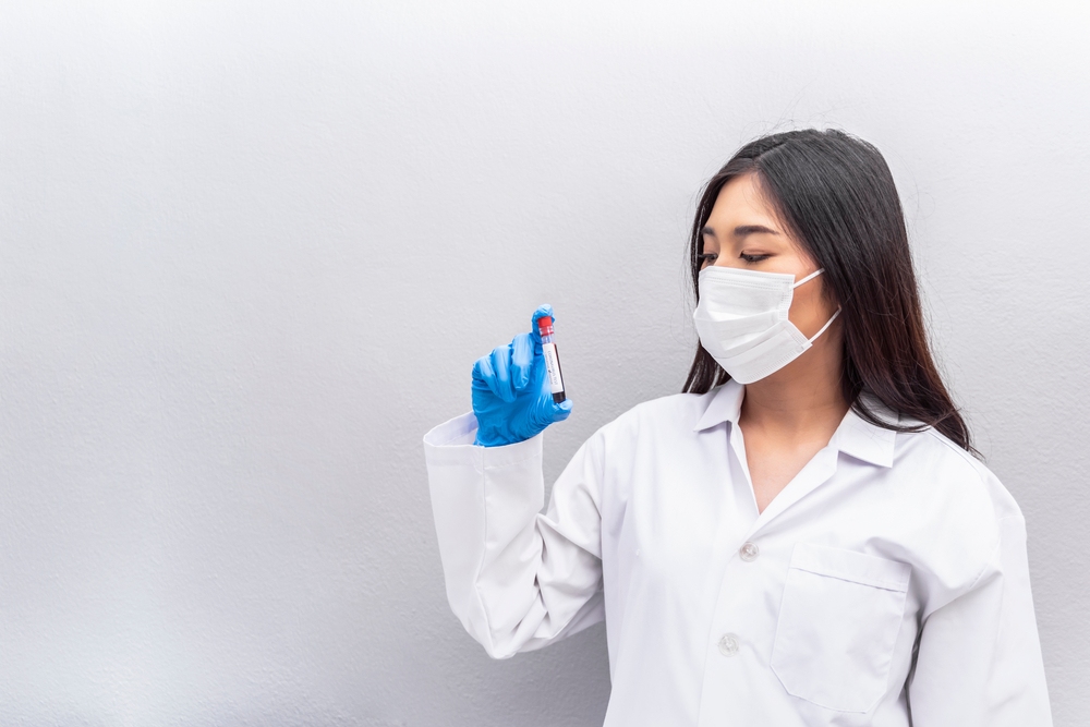 lưu ý khi làm xét nghiệm NIPT lưu ý khi xét nghiệm NIPT