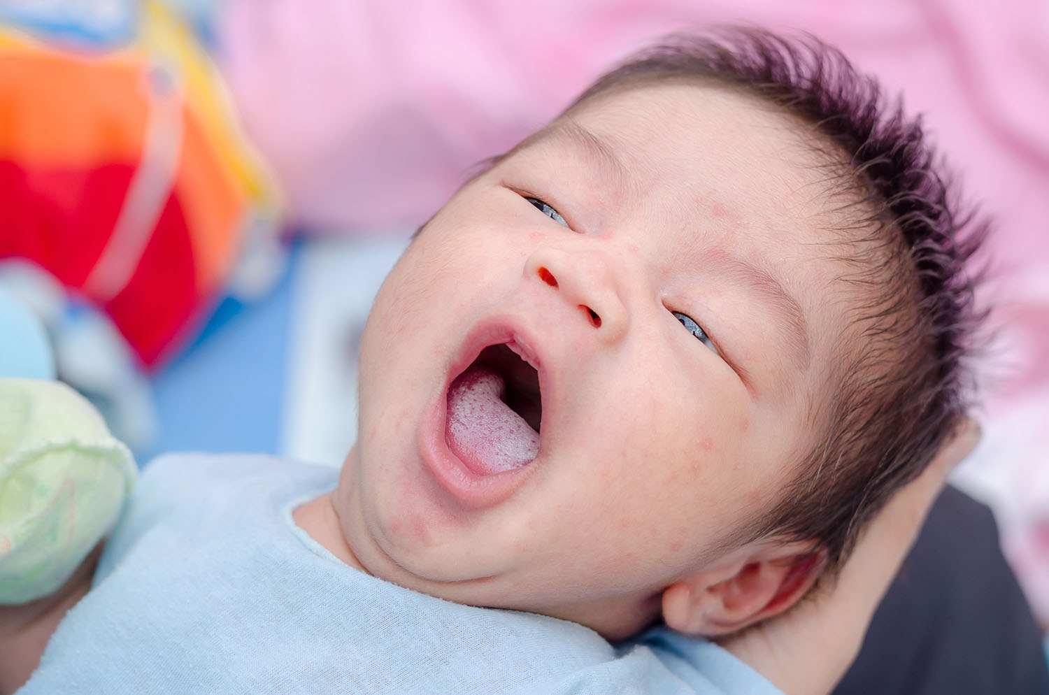 cách làm sạch lưỡi bị trắng cho trẻ sơ sinh do bé bị tưa miệng cách làm sạch lưỡi bị trắng cho trẻ sơ sinh do tưa miệng