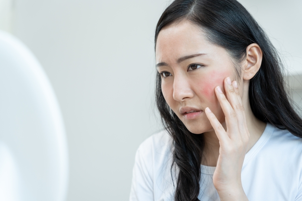 cách làm tan vết sưng trên mặt và vì sao lại bị sưng bầm sau khi va đập cách làm tan vết sưng trên mặt và tại sao lại bị sưng bầm sau khi va đập