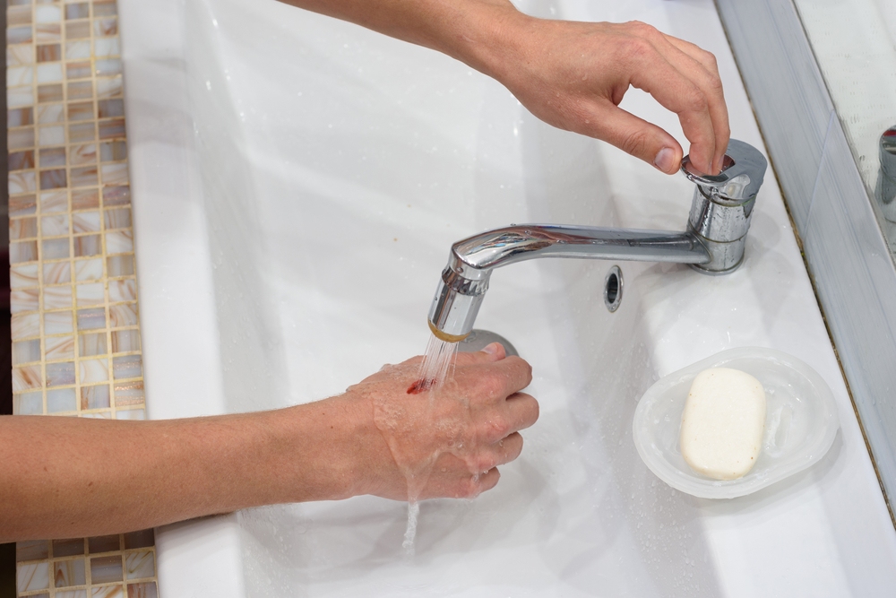 gợi ý cách làm vết thương hở mau khô đúng cách cách làm vết thương hở mau khô đúng cách