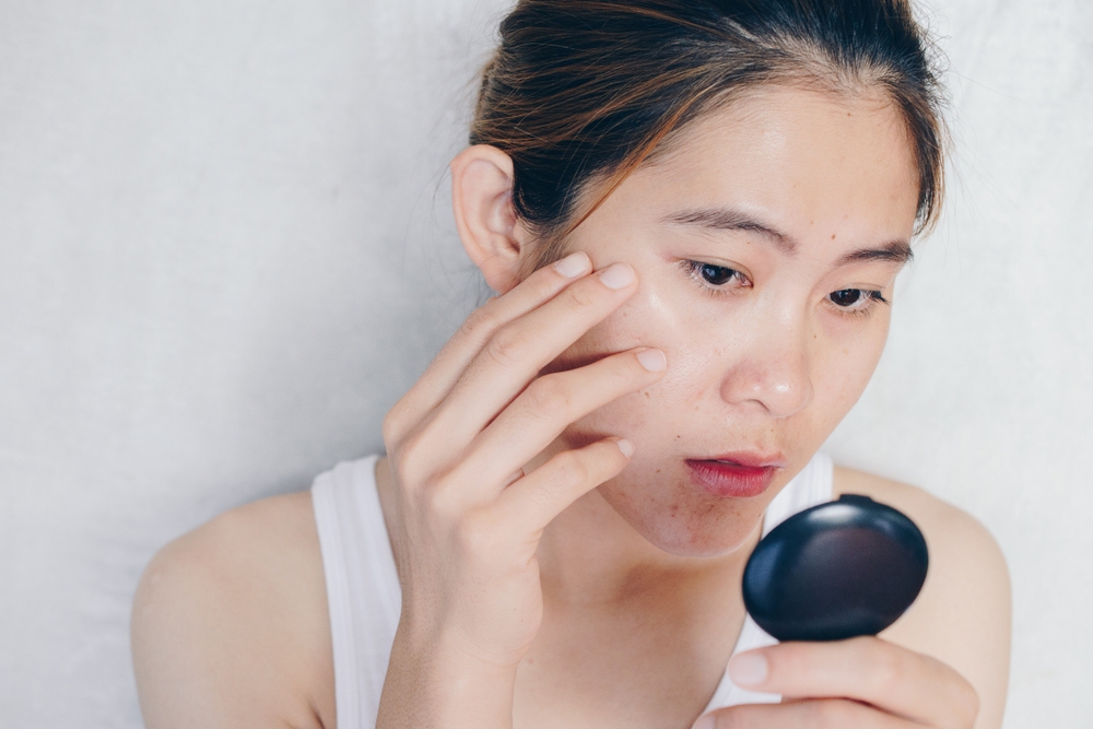 dưỡng ẩm cho da dầu mụn và tại sao da dầu mụn cần dưỡng ẩm dưỡng ẩm cho da dầu mụn và vì sao da dầu mụn cần dưỡng ẩm