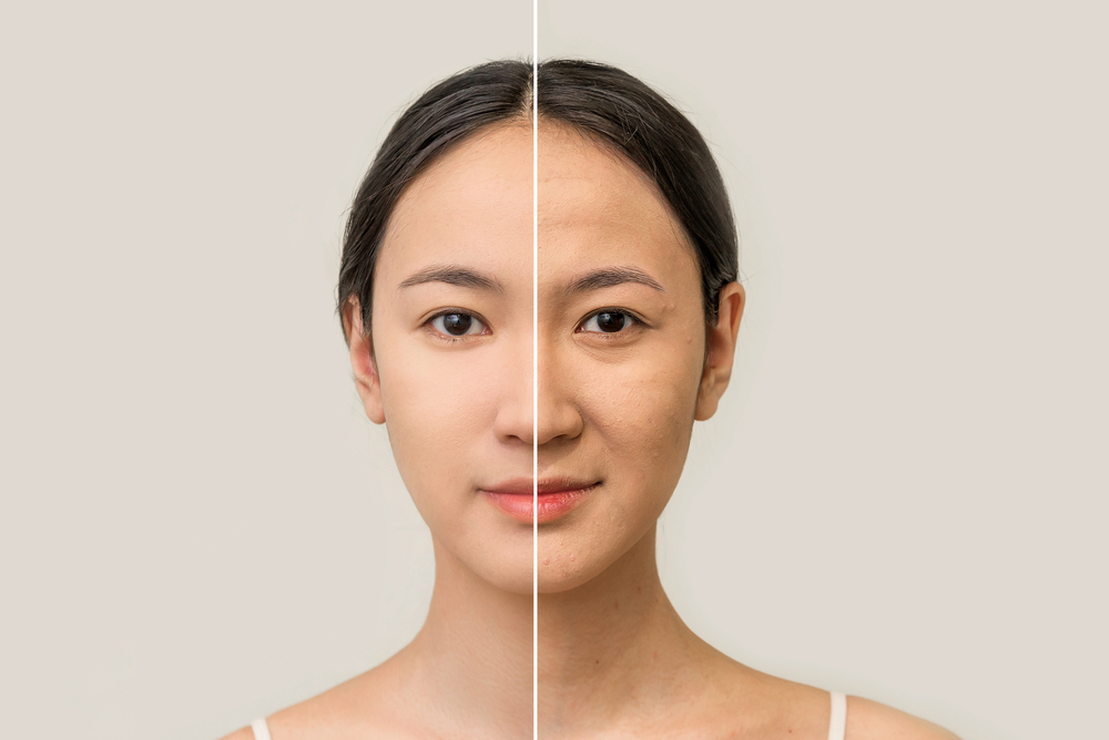 phái đẹp nên uống collagen dạng nào bạn nên uống collagen dạng nào
