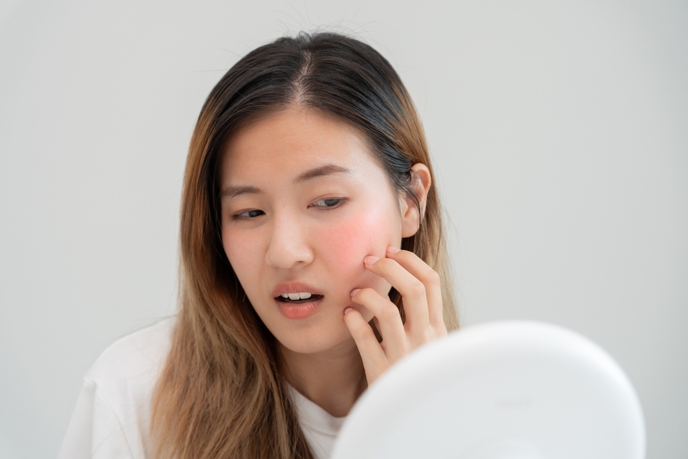 phục hồi da​ khi hàng rào da bị tổn thương