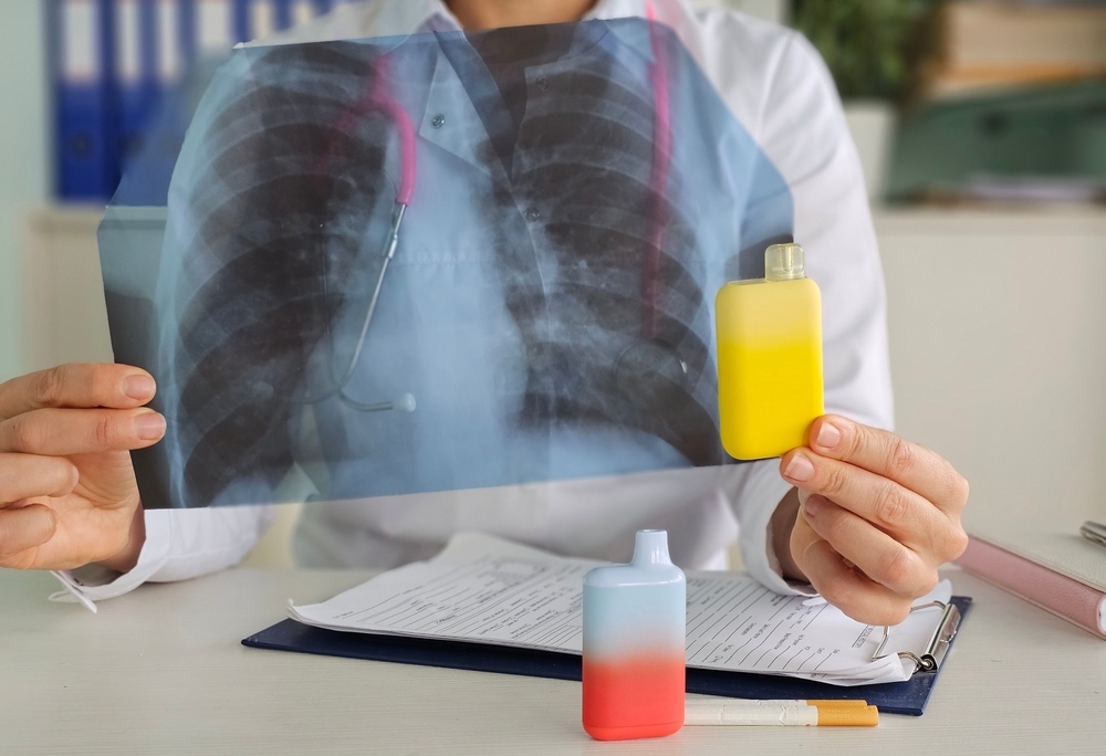 5 cách giúp ba mẹ ngăn chặn hiện tượng hút thuốc lá điện tử ở giới trẻ 29 hiện tượng hút thuốc lá điện tử ở giới trẻ