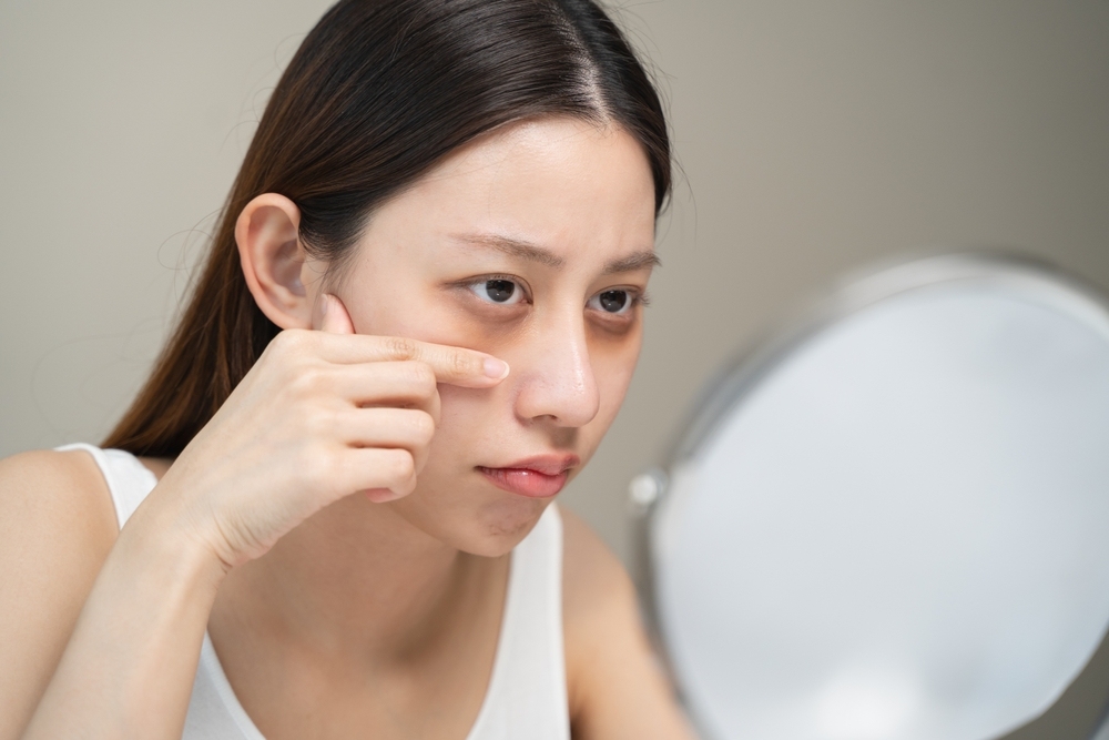 Thiếu ngủ ảnh hưởng tới làn da và ngoại hình Thiếu ngủ ảnh hưởng đến làn da và ngoại hình